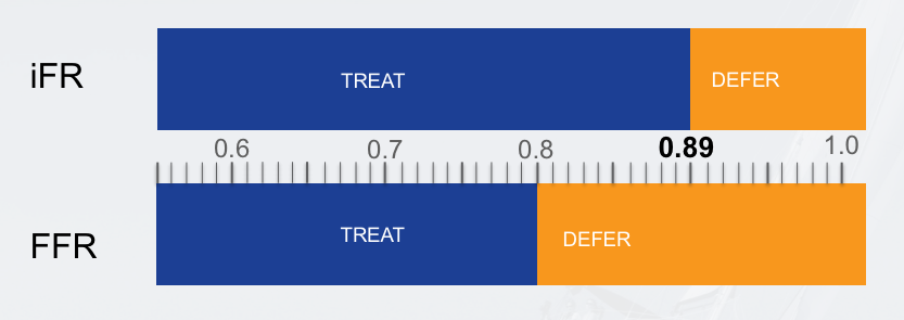 FFR and iFR in the Diagnosis and Treatment of Heart Disease | DAIC